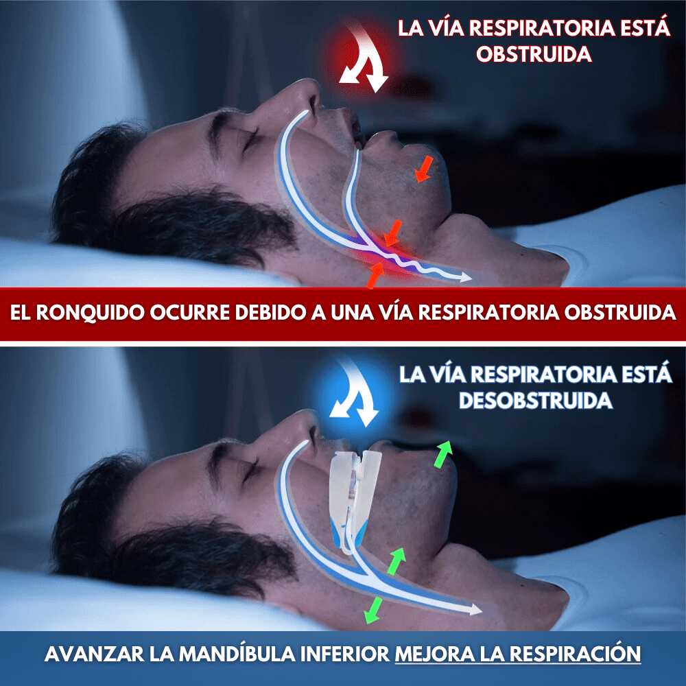 ZenSleep ® - Despídase de los Ronquidos y Disfrute de noches Tranquilas